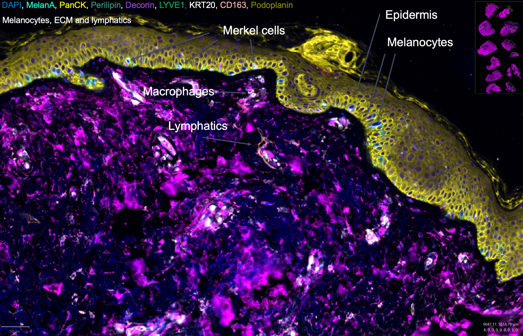 Skin: 40+ plex protein multiplex IF (markers shown include DAPI, MelanA, PanCK, Perilipin, Decorin, LYVE1, KRT20, CD163, Podoplanin) - melanocytes, Merkel cells, macrophages, lymphatics