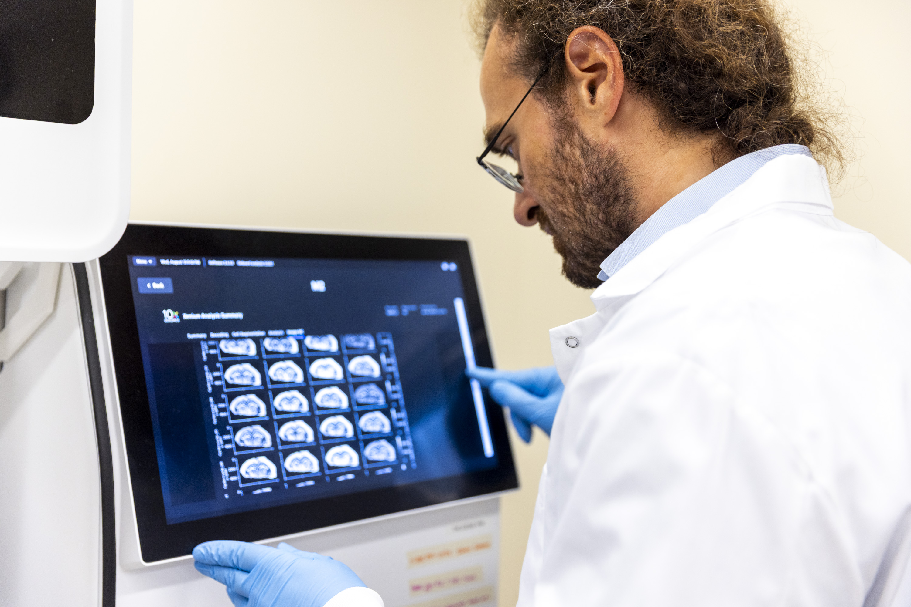 The Xenium Analyzer in the Spatial Technologies Unit